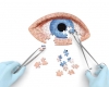 Muitas doenças nos olhos podem ter diagnóstico precoce e serem prevenidas